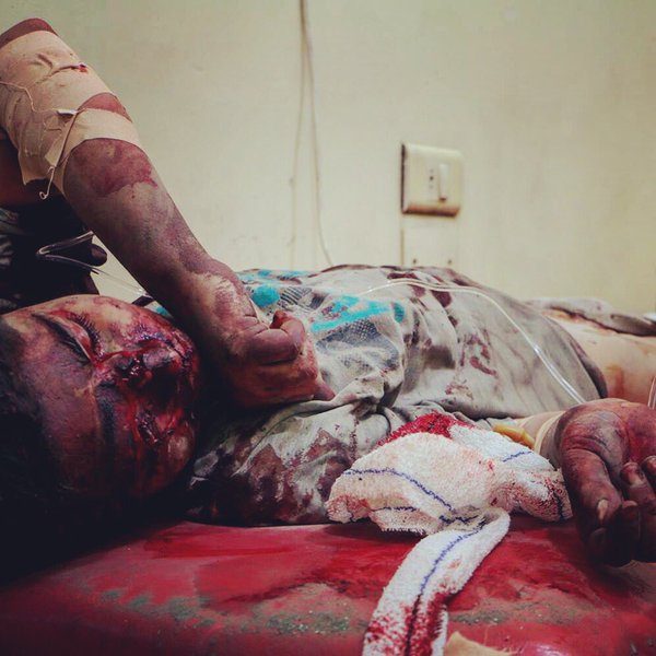 SNHR: 19.000 Syrian children killed by Assad regime since 2011