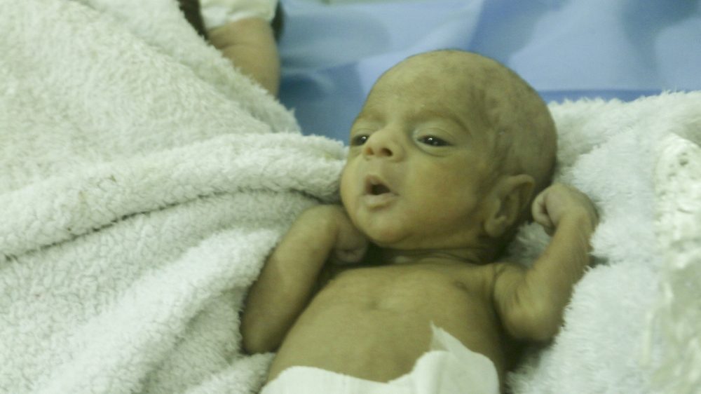 Syrian Crisis: Women risk death to give birth in Aleppo