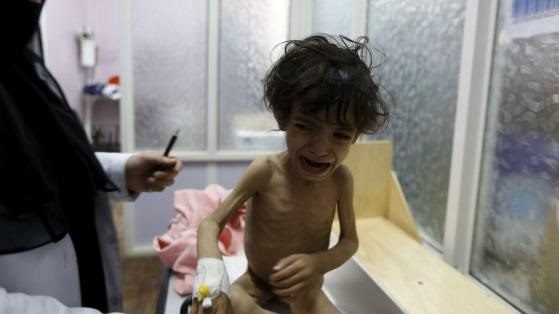 500 days of war in Yemen, Humanitarian crisis is the worst